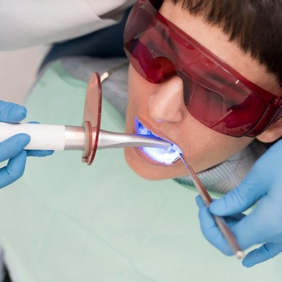 teeth scaling and polishing